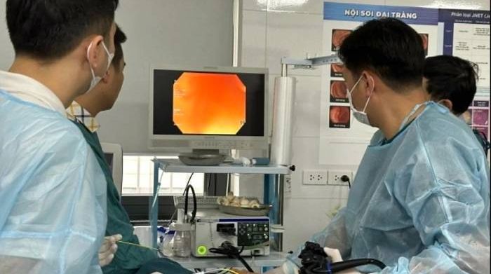 Ung thư tiêu hóa chiếm hơn 37% số ca tử vong do ung thư tại Việt Nam