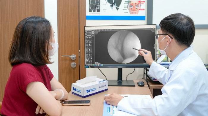 Đau đầu có phải dấu hiệu viêm xoang?