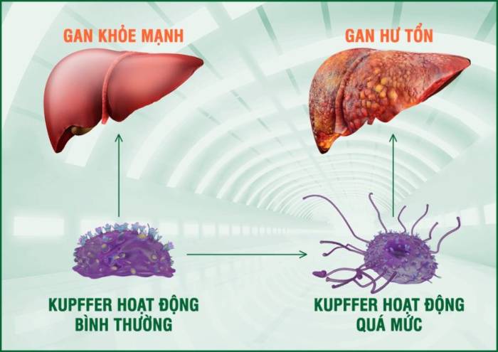 Rượu bia, thuốc lá kích hoạt tế bào kupffer hoạt động quá mức làm tổn thương gan và dẫn đến viêm gan, xơ gan, ung thư gan. Ảnh: Công ty Dược phẩm Eco