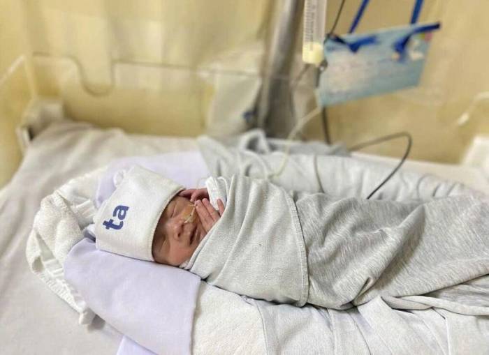 Bé được nằm chăm sóc tại phòng NICU của Khoa Sơ sinh. Ảnh: Bệnh viện Đa khoa Tâm Anh