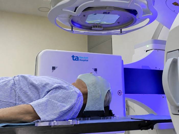 Bà Hương được xạ trị với hệ thống máy gia tốc tuyến tính kết hợp bolus 3D cá thể hóa dựa trên dữ liệu CT. Ảnh: Bệnh viện Đa khoa Tâm Anh