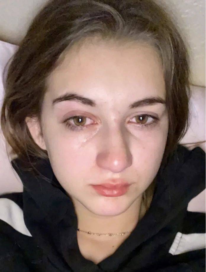 Abigail Beck (19 tuổi) ở thành phố Tucson, bang Arizona, Mỹ bị nôn mửa, da bỏng rát khi chạm vào nước. Ảnh: Kennedy News and Media