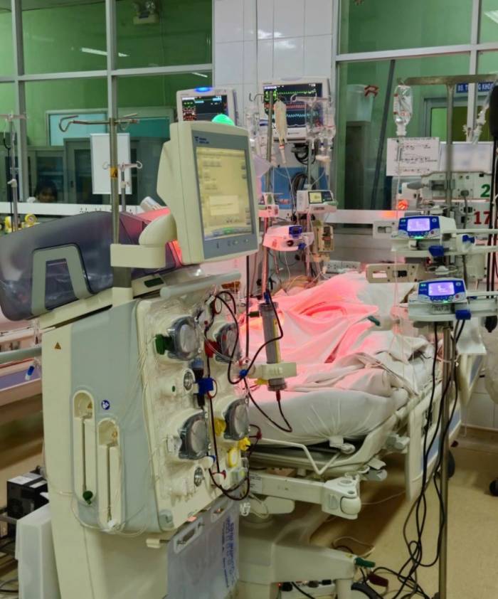 Người bệnh mắc sốt xuất huyết trong giai đoạn thở máy và ECMO. Ảnh: Bệnh viện Bệnh Nhiệt đới TP HCM