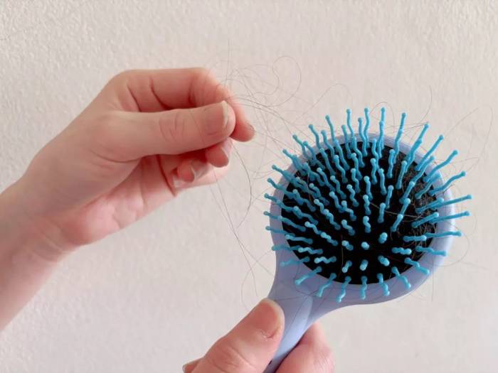 Thiếu sắt có thể gây rụng tóc. Ảnh: Bảo Bảo