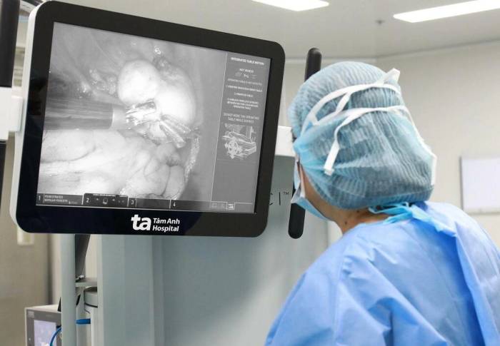 Khối u quái buồng trứng kích thước lớn ở khoang chậu được robot bóc tách thành công. Ảnh: Bệnh viện Đa khoa Tâm Anh