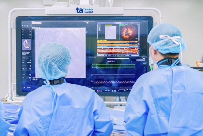 Các bác sĩ can thiệp đặt stent mở rộng mạch máu nuôi tim cho bệnh nhân với sự hỗ trợ của hệ thống chụp cắt lớp kết quang nội mạch (OCT). Ảnh: Bệnh viện Đa khoa Tâm Anh