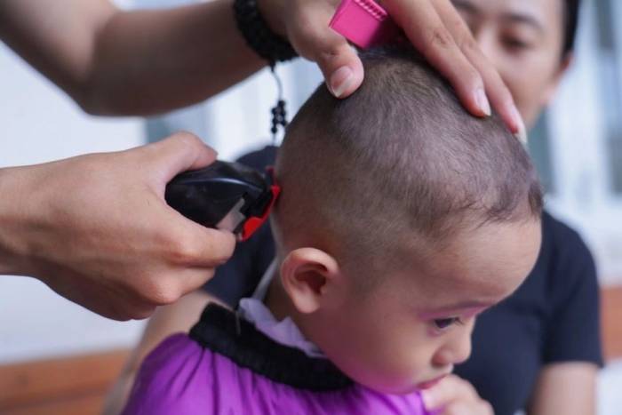 Bệnh nhi được hớt tóc khi đang nằm viện. Ảnh: Minh Toàn