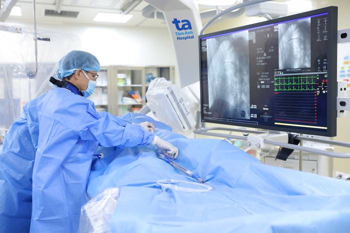 Phó giáo sư Vũ Hữu Vĩnh can thiệp đặt stent cho người bệnh hẹp động mạch chi dưới. Ảnh minh họa: Bệnh viện Đa khoa Tâm Anh