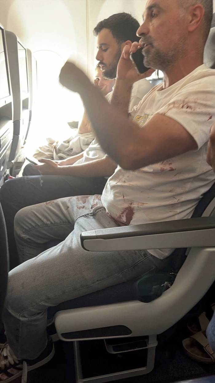 Áo của hành khách trên chuyến bay flydubai bị dính máu sau sự cố ngày 30/9. Ảnh: X/Amichai Stein
