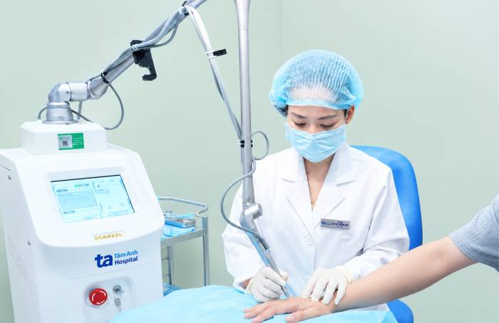 Bác sĩ Duy sử dụng laser CO2 điều trị mụn thịt dư cho người bệnh. Ảnh: Phòng khám Đa khoa Tâm Anh Quận 7
