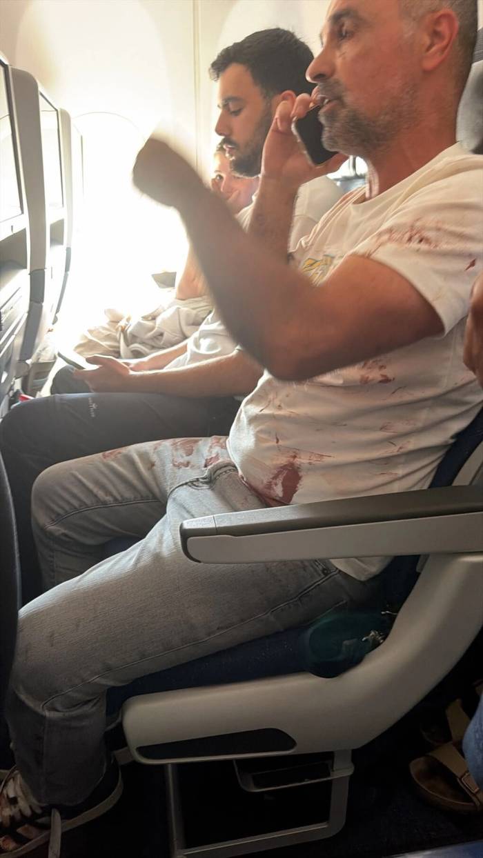 Áo của hành khách trên chuyến bay Flydubai bị dính máu sau sự cố ngày 30/9. Ảnh: X/Amichai Stein