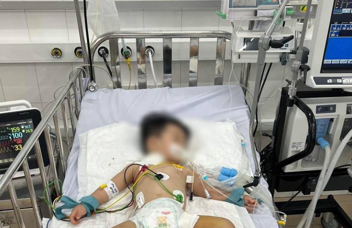 Trẻ mắc tay chân miệng nặng được điều trị tích cực tại Bệnh viện Nhi đồng 1 (TP HCM). Ảnh: Anh Đào