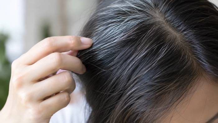 Tóc bạc có liên quan đến yếu tố di truyền. Ảnh được tạo bởi AI