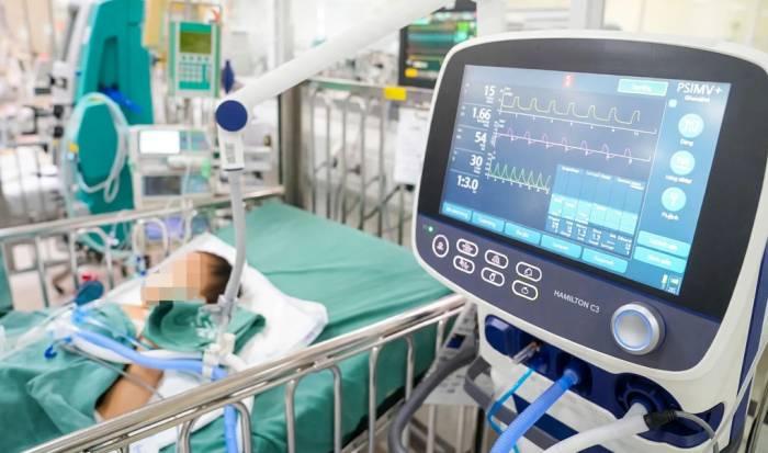 Một bệnh nhi điều trị tích cực do cúm A tại Bệnh viện Nhi Trung ương. Ảnh: Bệnh viện Nhi Trung ương