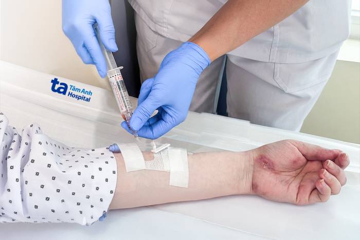 Chị Thảo được truyền thuốc sinh học đợt đầu tiên để kiểm soát tình trạng lupus. Ảnh: Bệnh viện Đa khoa Tâm Anh