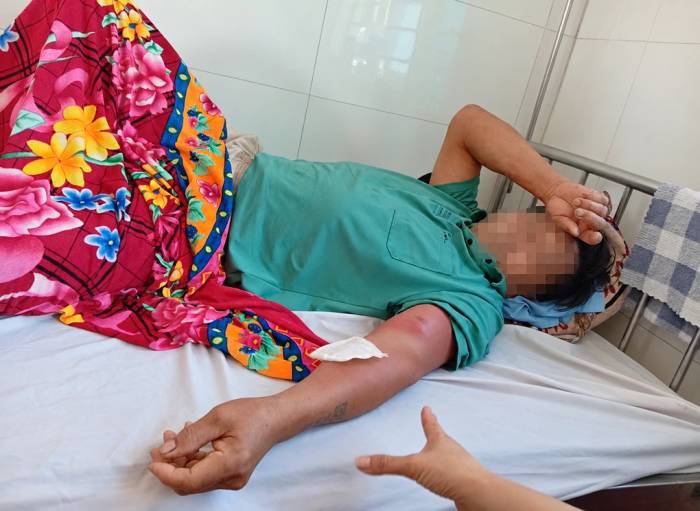 Nam bệnh nhân nhiễm bệnh giun rồng ở xã Linh Sơn. Ảnh: Lam Sơn