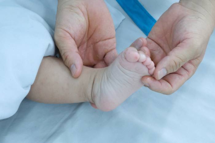Tổn thương tay chân miệng thường tập trung ở lòng bàn tay, lòng bàn chân, đầu gối, mông... có thể nhầm với côn trùng cắn. Ảnh: Bình An