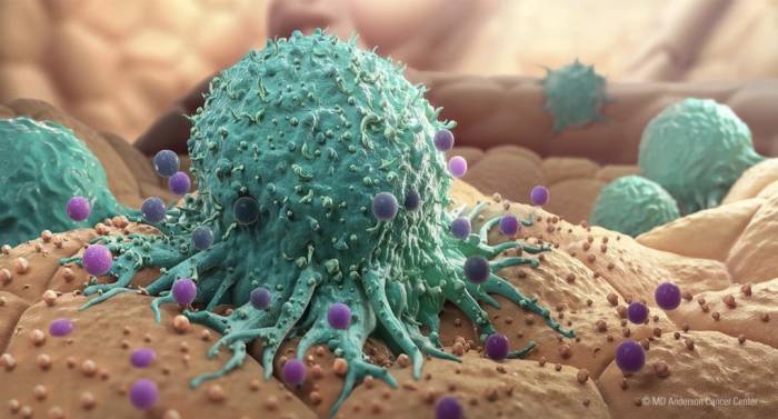 Mô phỏng tế bào ung thư đang lây lan các mô khỏe mạnh. Ảnh: MD Anderson Cancer Canter
